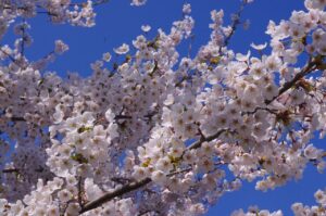 札幌でのホワイトニングを個室で受ける際の相談ポイントは？